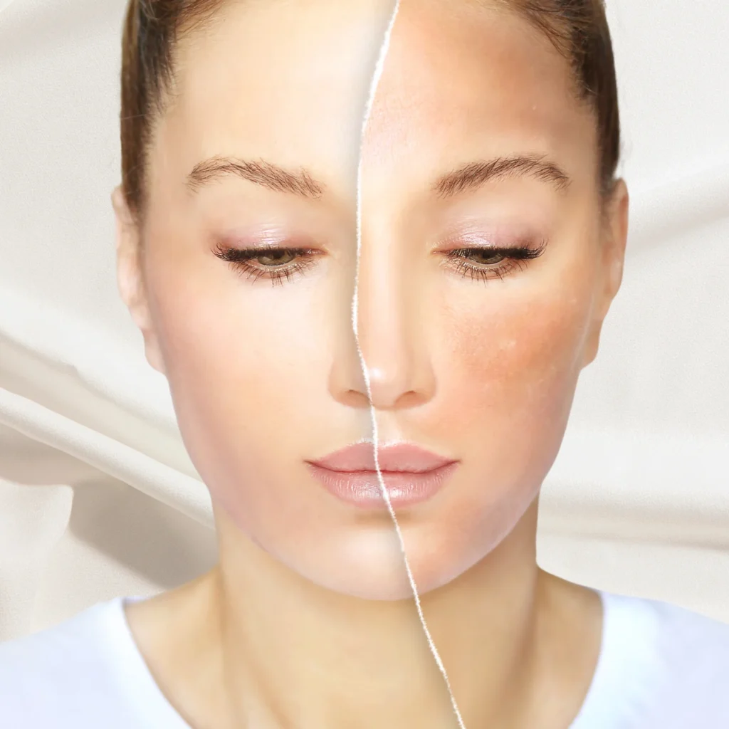 Skin whitening treatment at a clinic in Kolkata
